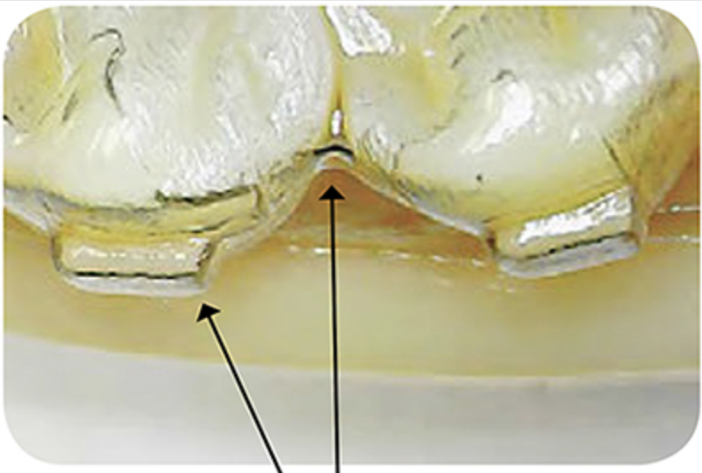 Matériau thermoplastique « standard »